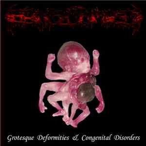 Laryngectomized - Grotesque Deformities & Congenital Disorders album