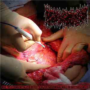 Bowel Fermentation - Multiple Congenitalized Defects Of The Abdominal Wall In Gastroschisis album