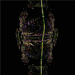 Xyphosenphia - Odoacer slilin album